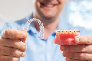 Braces vs Invisalign — Which Is Right for You?