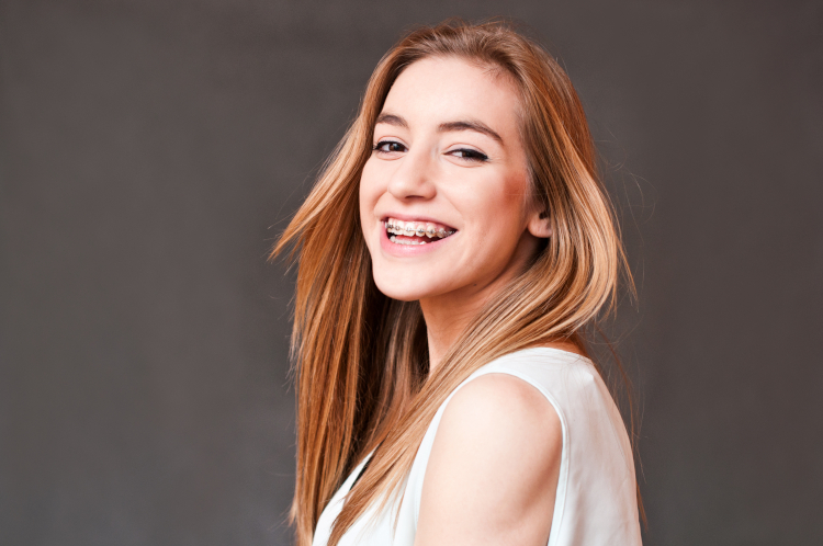 How Long Do Braces Usually Take?